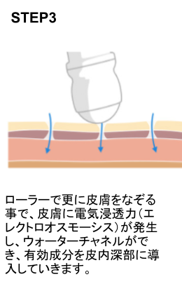 デルマシオSTEP3