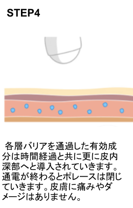 デルマシオSTEP4