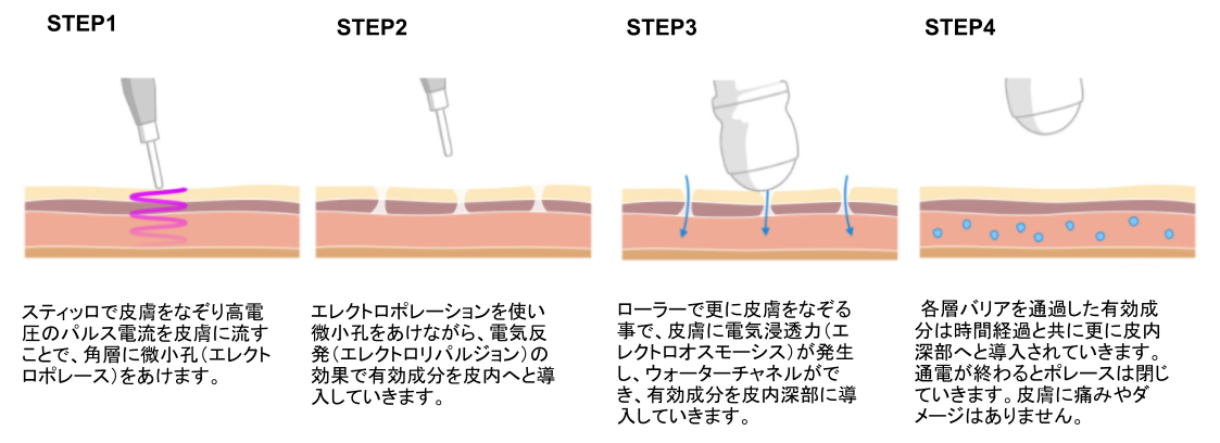 デルマシオSTEP